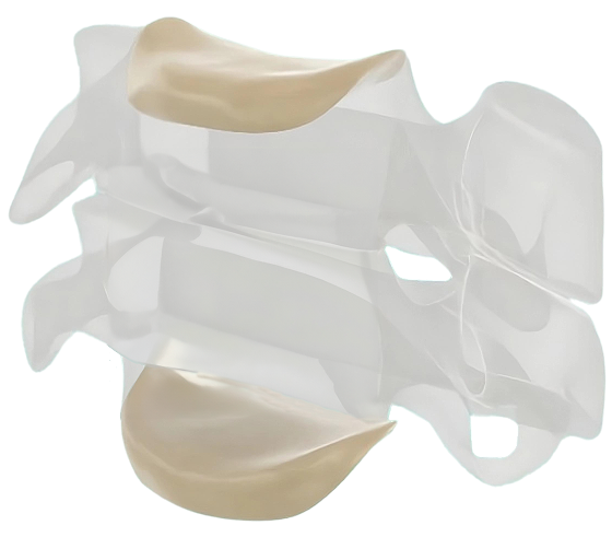 Anterior Cervical
