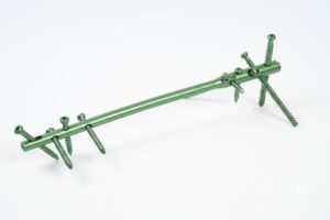 Multilock distal femur intramedullary nail manufacturer India
